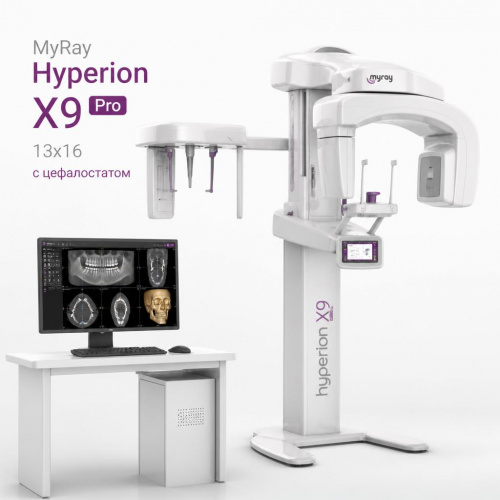 MyRay_Hyperion